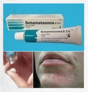 para que sirve la betametasona para que sirve la betametasona