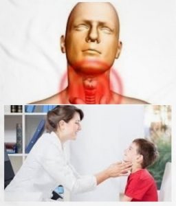 dosis de paracetamol en niños que es paracetamol