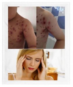 ibuprofeno ibuprofeno para niños