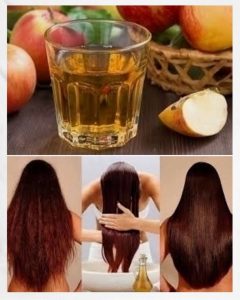 para que sirve el vinagre de manzana